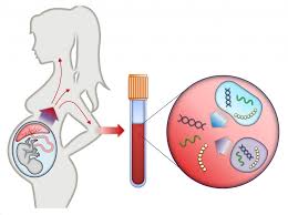 prenatal dna testing