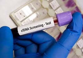 cfdna test