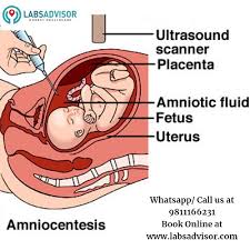 in utero dna test