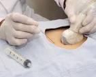 amniocentesis for paternity