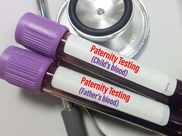 amniocentesis dna test cost